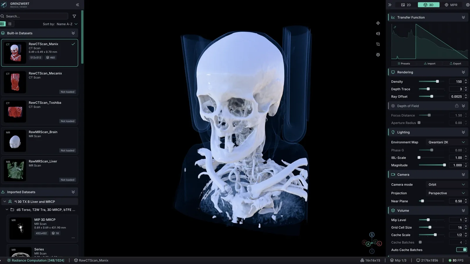 Grenzwert 3D volume rendering workspace with CT anatomy and rendering controls