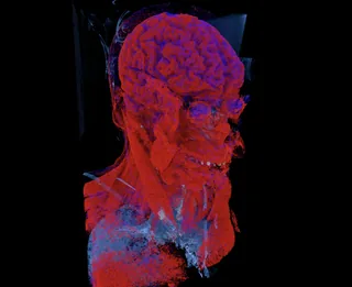 MANIX head CT scan rendered in 3D with red soft-tissue volume rendering
