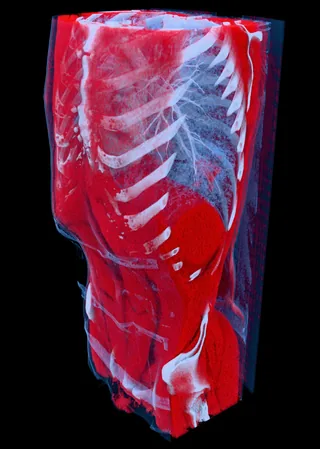 MECANIX torso CT scan rendered in 3D showing lungs, ribs, and soft tissue